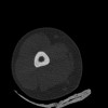 SPORK, NICO - 22.03.1976 - 02.08.2022 - CT obere Extremität - 17:51:17